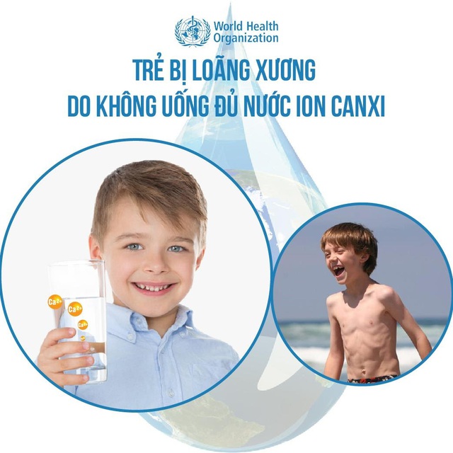 Nước ion canxi ngăn chặn tình trạng loãng xương ở trẻ nhỏ  - Ảnh 1.