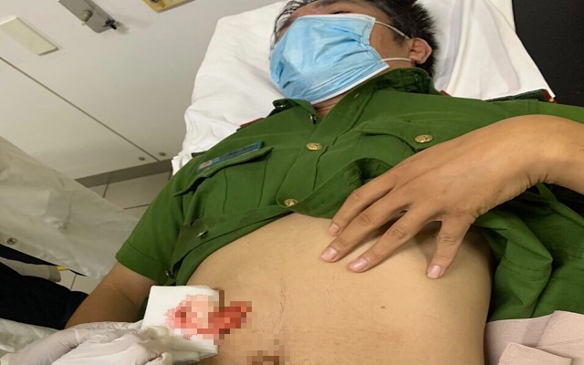 Chiến sĩ công an ở Thừa Thiên Huế bị đâm trọng thương khi đang làm nhiệm vụ  - Ảnh 1.