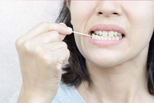 5 thói quen tàn phá răng lợi của bạn, không muốn hỏng răng sớm cần tránh ngay - Ảnh 6.