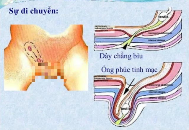 Căn bệnh nguy hiểm cứ 100 trẻ thì có đến 5 trẻ mắc, cha mẹ lại dễ bỏ qua  - Ảnh 1.