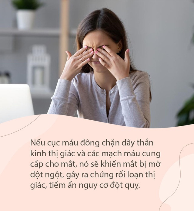 Chỉ với một tờ giấy trắng, bạn sẽ biết mình có nguy cơ đột quỵ không: Dù bận rộn đến đâu cũng nên dành 10 giây để tự kiểm tra - Ảnh 1.