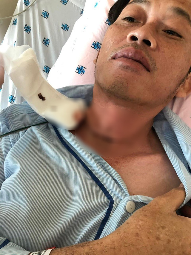 Bác sĩ: Hoài Linh bắt đầu xạ trị vào tháng 10, khả năng là phẫu thuật từ tháng 9 vì mổ xong sau 3-4 tuần mới bắt đầu điều trị - Ảnh 2.