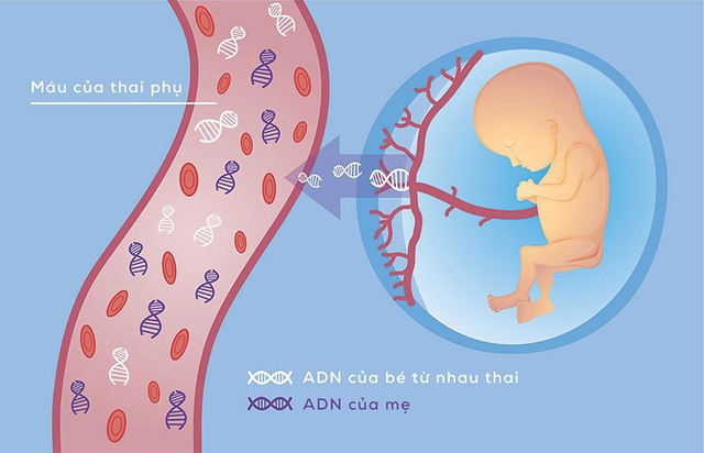 Sàng lọc dị tật thai nhi ngay tại nhà - Giúp mẹ an tâm cho một thai kỳ khỏe mạnh - Ảnh 2.