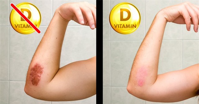 8 dấu hiệu của cơ thể nhắc nhở bạn cần bổ sung ngay vitamin D - Ảnh 5.