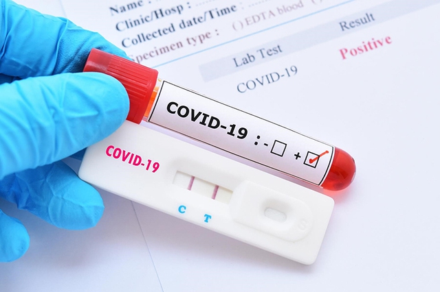 Có nên dùng test nhanh COVID-19 mua trên mạng? - Ảnh 2.