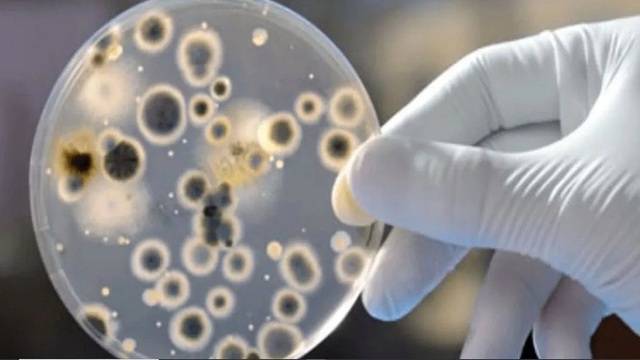  Mỹ phát hiện ca bệnh nấm nguy hiểm chết người có thể kháng mọi loại thuốc  - Ảnh 1.
