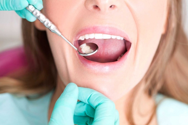 8 quy tắc cần ghi nhớ với răng nhạy cảm - Ảnh 8.