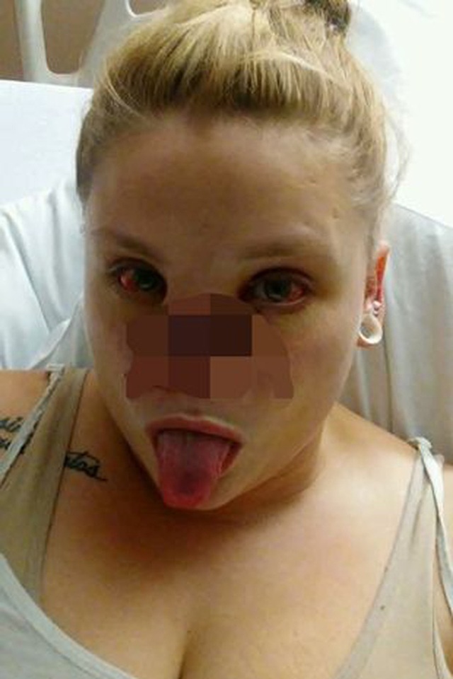 Bị chó pitbull hung dữ cắn đứt lìa mũi ra khỏi mặt, người phụ nữ chia sẻ hình ảnh diện mạo mới ở hiện tại sau 4 năm gây bất ngờ - Ảnh 3.