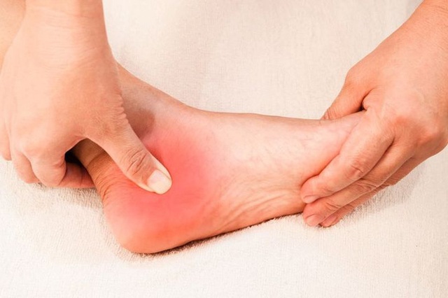 Nhìn bàn chân đoán bệnh: Có 4 điểm bất thường trên bàn chân, cần đi khám thận khẩn cấp - Ảnh 3.