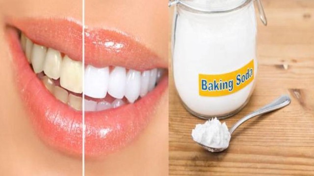 Dùng baking soda chăm sóc răng miệng tốt, nhưng phạm phải sai lầm này lại hại vô cùng - Ảnh 1.