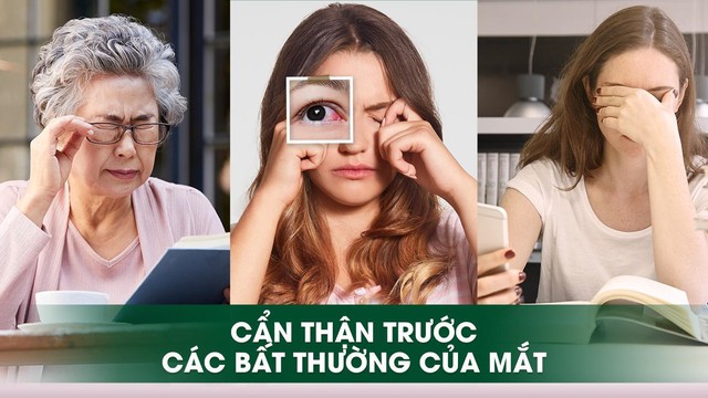 Đừng lơ là với bệnh khô mắt ngày một tăng - Ảnh 2.