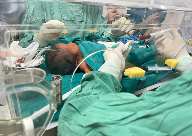 Thay máu toàn phần, bác sĩ Hải Phòng cứu bé trai sơ sinh 3 ngày tuổi  - Ảnh 2.
