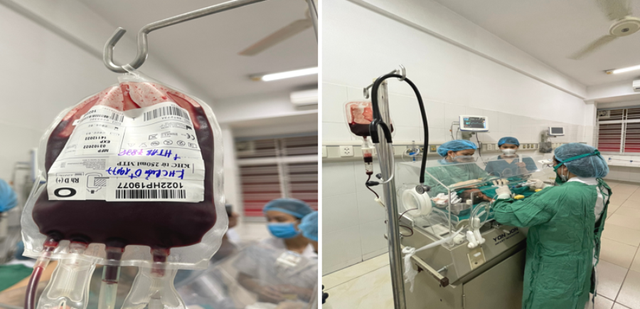 Thay máu toàn phần, bác sĩ Hải Phòng cứu bé trai sơ sinh 3 ngày tuổi  - Ảnh 1.