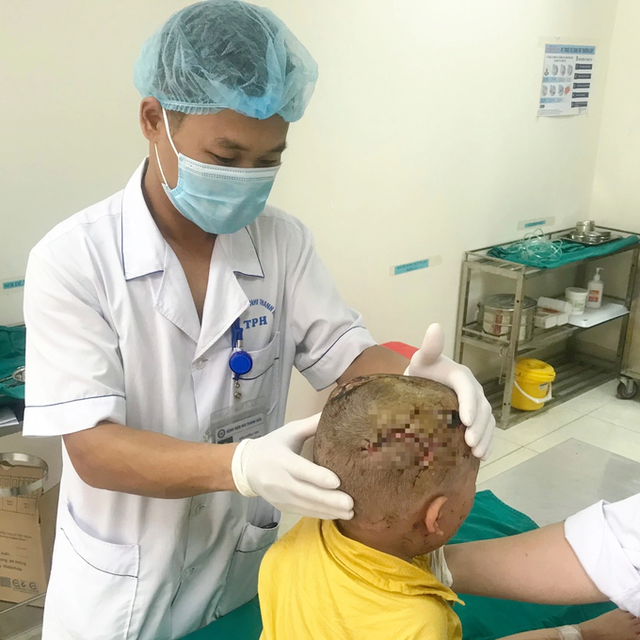 Bé 2 tuổi ở Thanh Hóa đang chơi bỗng nhiên bị chó cắn nát vùng mặt - Ảnh 2.