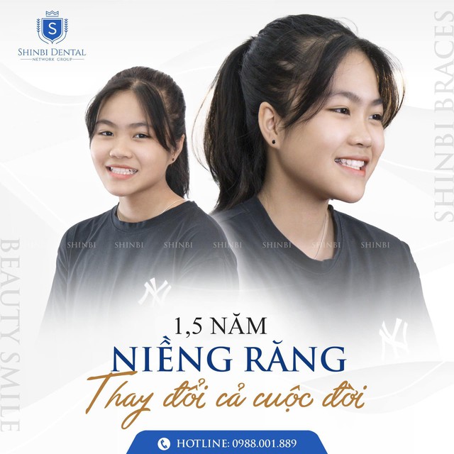 Người Việt đầu tư &quot;nụ cười&quot;, làm đẹp răng cuối năm đón điều may mắn - Ảnh 1.