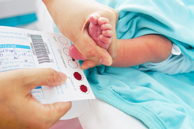 Thực trạng bệnh Thalassemia tại Việt Nam: Cần phải tầm soát kịp thời để loại trừ nguy cơ mắc bệnh! - Ảnh 2. Thực trạng bệnh Thalassemia tại Việt Nam: Cần phải tầm soát kịp thời để loại trừ nguy cơ mắc bệnh! - Ảnh 2.