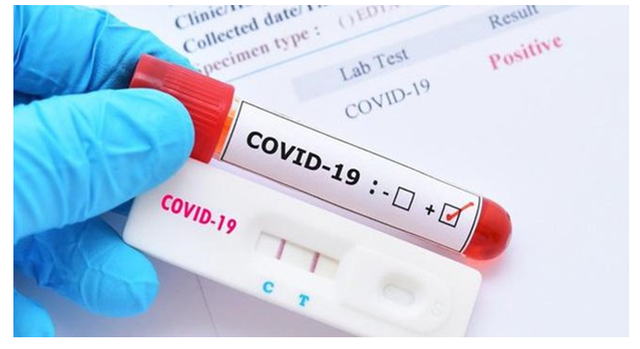 Thời điểm nào nên xét nghiệm COVID-19 sau khi tiếp xúc F0 để có kết quả chính xác nhất? - Ảnh 3.
