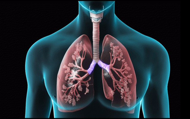 4 nhóm người có nguy cơ bị xơ phổi hậu COVID-19, có dấu hiệu này cần đi khám sớm! - Ảnh 2.