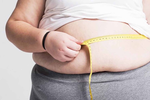 Người thừa cân, béo phì phòng tránh bệnh hậu COVID-19 thế nào cho hiệu quả? - Ảnh 2.