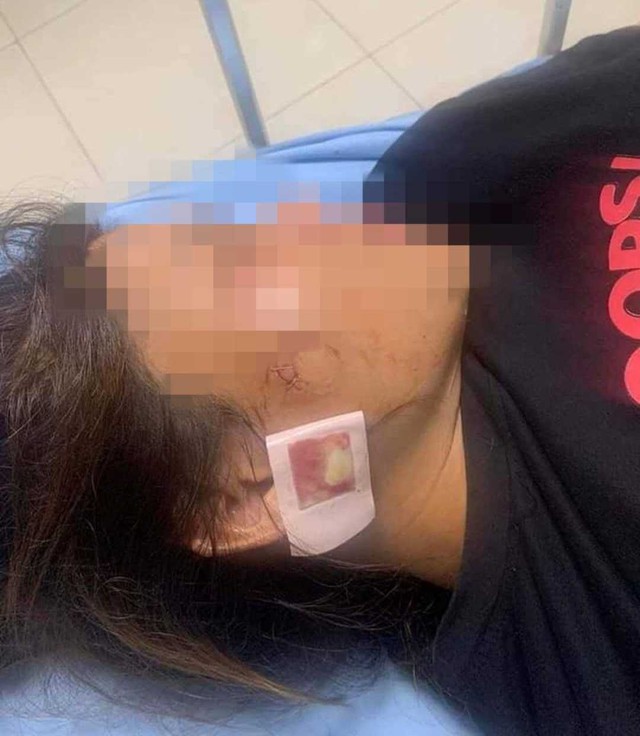 Thanh Hoá: Xác minh thông tin người phụ nữ bị thương nghi do súng bắn - Ảnh 1.