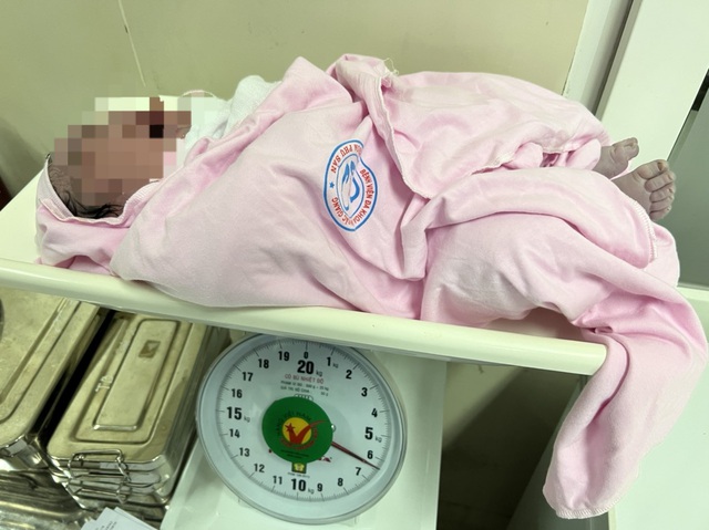Em bé ở Bắc Giang chào đời với cân nặng ‘khủng’ hơn 6kg - Ảnh 2.