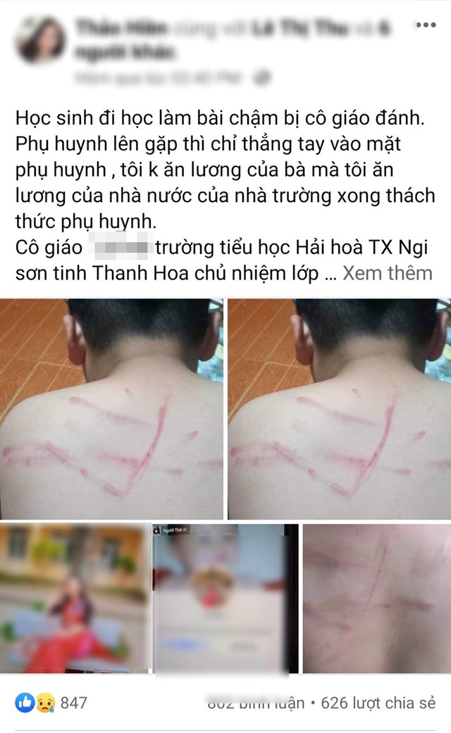 Thanh Hóa: Không làm bài tập học sinh bị cô giáo đánh bầm tím lưng  - Ảnh 2.