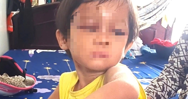 Bé gái 4 tuổi nghi bị cha nuôi bạo hành - Ảnh 1.