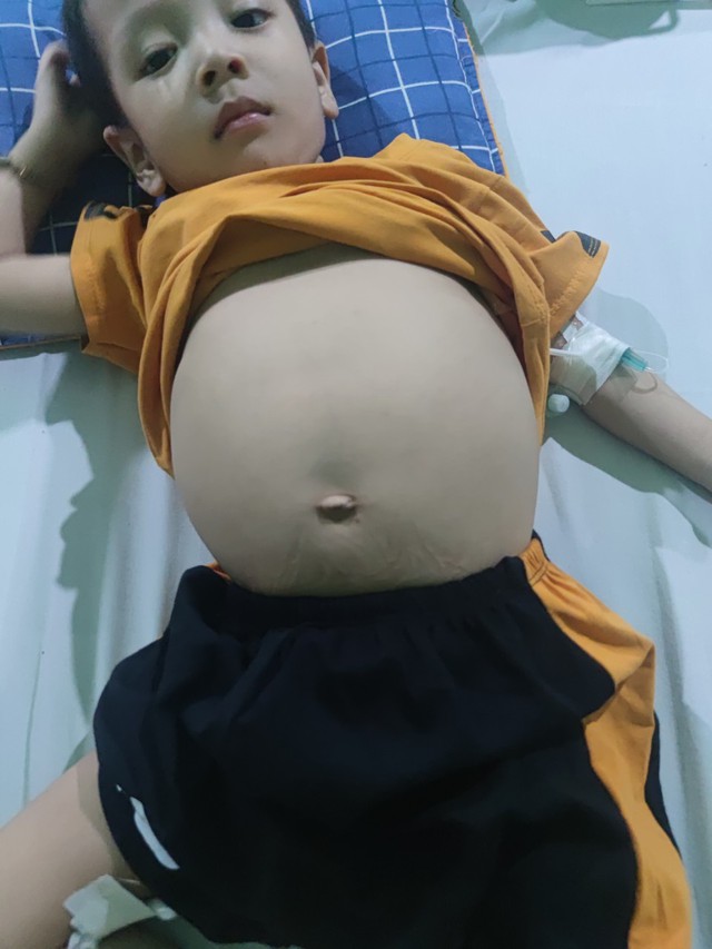 XMS 895: Xót xa gia cảnh của bé trai 3 tuổi cơ thể suy yếu, bụng to dần như trống - Ảnh 2.