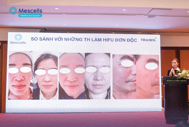 Workshop 2023 với chủ đề “Centerless Focused Ultrasound - Công nghệ sóng siêu âm hội tụ đến từ Châu Âu  - Ảnh 1.