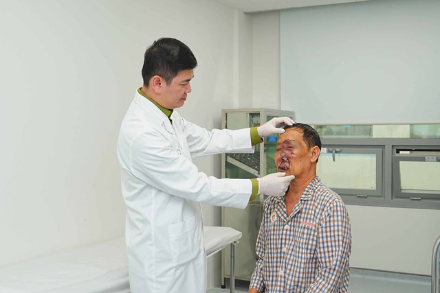 Bóc tách khối u như ‘chùm nho’ trên mặt nam bệnh nhân 74 tuổi - Ảnh 2.