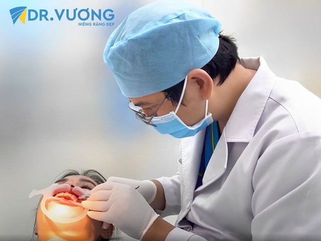 Loại mắc cài được chuyên gia Dr. Vương khuyên dùng trong niềng răng - Ảnh 1.
