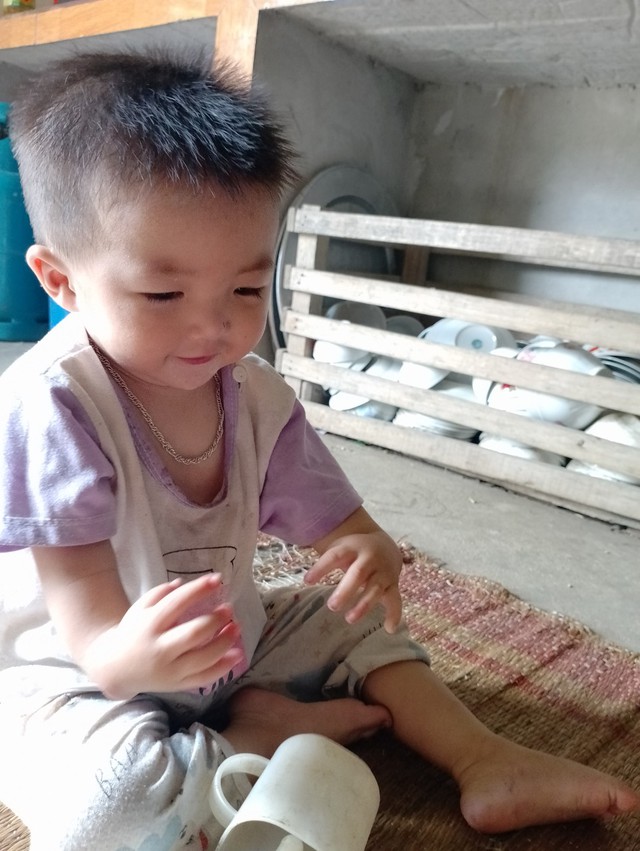 Khuyết tật đôi tay, giờ bé trai dân tộc Dao cần 50 triệu đồng để phẫu thuật tim - Ảnh 2.