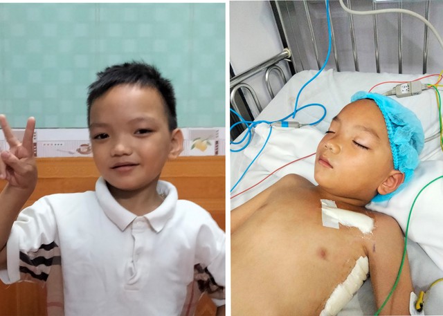 Thiếu tướng Đinh Văn Nơi trao 50 triệu đồng hỗ trợ bé trai 7 tuổi mổ tim - Ảnh 1.