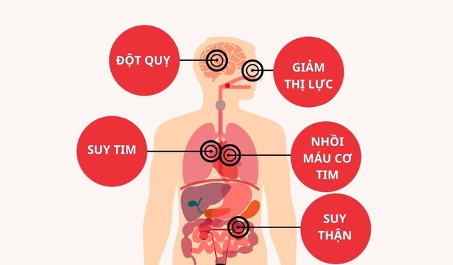 7 cách hỗ trợ hạ huyết áp tại nhà đơn giản mà hiệu quả  - Ảnh 1.