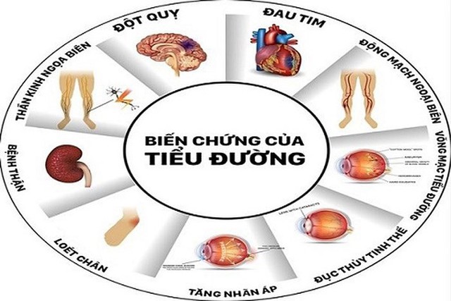 Từ bỏ ngay 7 thói quen tăng nguy cơ mắc tiểu đường này, ai không có xin chúc mừng! - Ảnh 3.