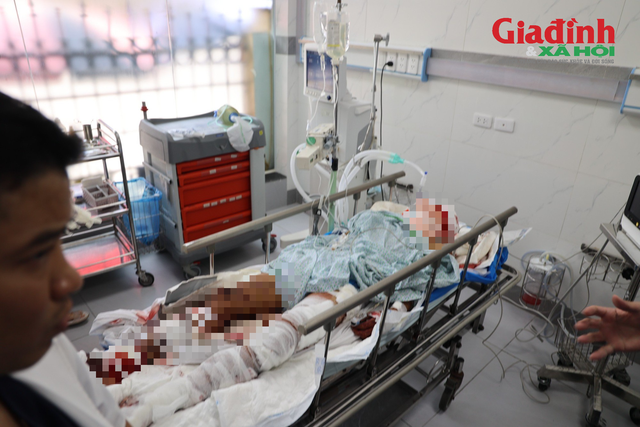 Vụ nổ bình gas ở Yên Phụ, sức khỏe hai nạn nhân được điều trị tại Bệnh viện Bỏng quốc gia hiện ra sao? - Ảnh 2.