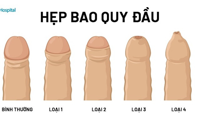 hep-bao-quy-dau-17319166205511780608823.jpg