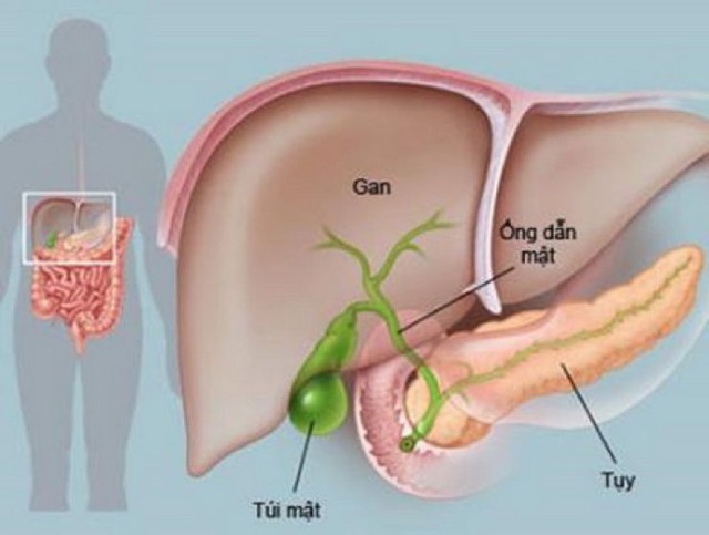 Người đàn ông 42 tuổi ở Phú Thọ bị viêm tụy cấp thừa nhận có thói quen nhiều nam giới Việt mắc phải - Ảnh 3.