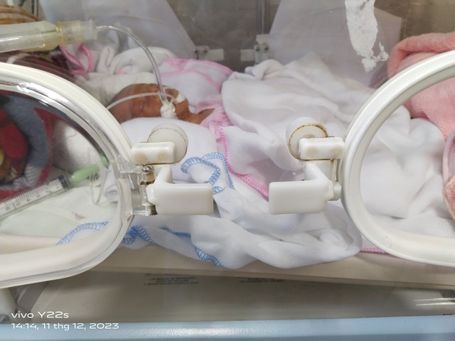 Lạng Sơn: Hành trình 68 ngày đưa cháu bé sinh non 900 gram 'về vạch đích'- Ảnh 1.