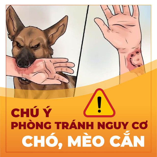 Bé gái 5 tuổi đang chơi bị chó cắn tới tấp, bác sĩ khuyến cáo cách phòng tránh bệnh dại từ vật nuôi - Ảnh 3.