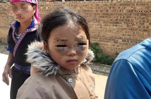 Công an vào cuộc làm rõ vụ bé gái lớp 1 nghi bị cô giáo đánh tím mắt ở Yên Bái - Ảnh 3.