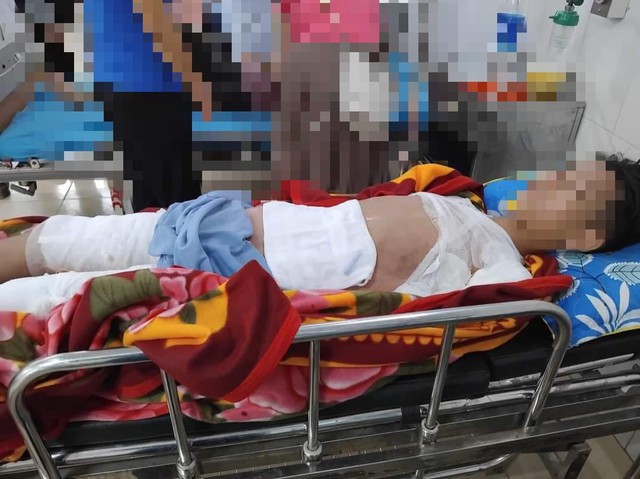 Nam sinh 11 tuổi ở Tuyên Quang phải đi cấp cứu với vết thương vùng kín nặng nề do tai nạn không ngờ tới- Ảnh 1.