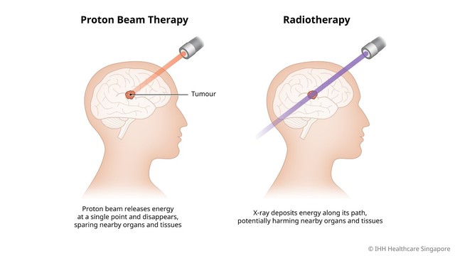 Liệu pháp nhắm trúng đích trong điều trị ung thư sử dụng độ chính xác của chùm tia proton- Ảnh 2.