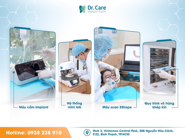 Dr. Care: Nha khoa tiên phong ứng dụng công nghệ cao trong trồng răng Implant- Ảnh 2.