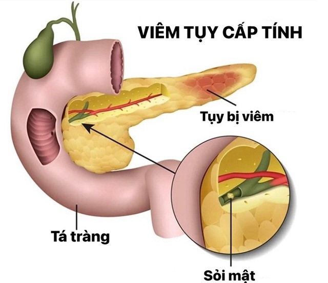 viem-tuy-cap5-1760426181298333371157.jpg