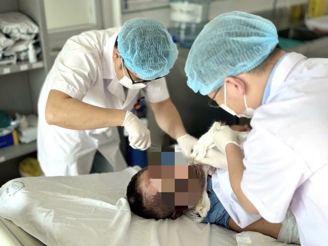 Người đàn ông bị bỏng nặng, nguy kịch khi giữ thang cho hàng xóm sửa điện - Ảnh 1.