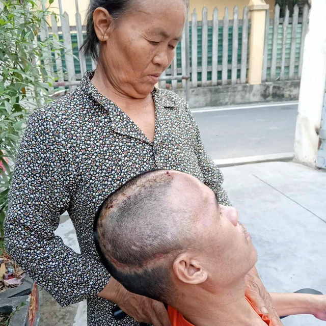 MS 1042: Xót xa hoàn cảnh người đàn ông đơn thân chăm mẹ già và con nhỏ gặp tai nạn nghiêm trọng cần tiền ghép sọ não - Ảnh 2. MS 1042: Xót xa hoàn cảnh người đàn ông đơn thân chăm mẹ già và con nhỏ gặp tai nạn nghiêm trọng cần tiền ghép sọ não - Ảnh 2.