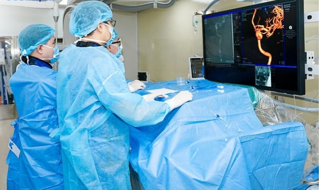 Người phụ nữ 35 tuổi bị đau đầu, đi khám bất ngờ phát hiện phình mạch máu não nguy cơ vỡ cao - Ảnh 1. Người phụ nữ 35 tuổi bị đau đầu, đi khám bất ngờ phát hiện phình mạch máu não nguy cơ vỡ cao - Ảnh 1.