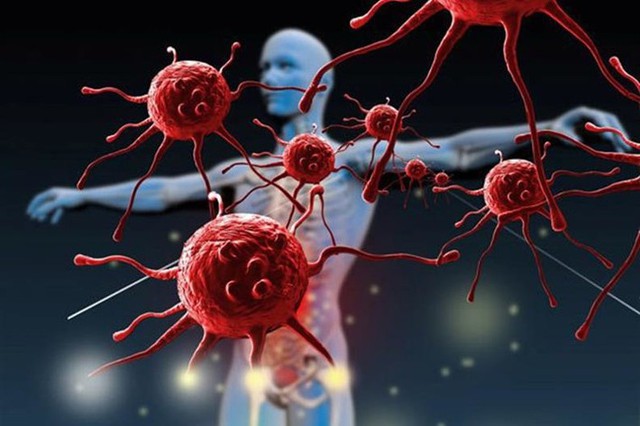 Tài tử Hứa Thiệu Hùng qua đời, căn bệnh của ông mắc phải nguy hiểm ra sao? - Ảnh 3. Tài tử Hứa Thiệu Hùng qua đời, căn bệnh của ông mắc phải nguy hiểm ra sao? - Ảnh 3.