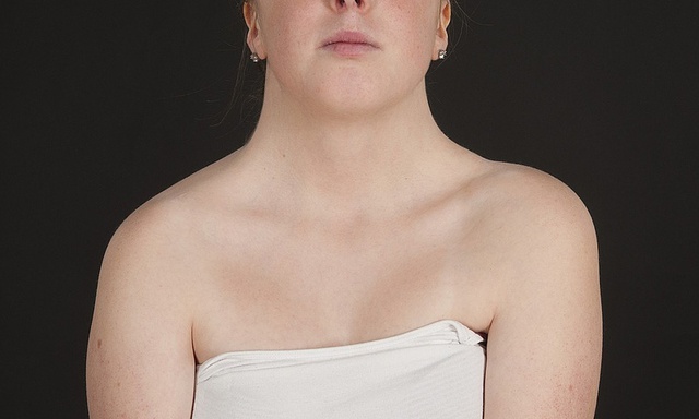 Hy Hữu: Thai phụ 27 tuổi phát hiện bệnh lý hiếm gặp trong lần làm xét nghiệm không xâm lấn (NIPT) - Ảnh 1. Hy Hữu: Thai phụ 27 tuổi phát hiện bệnh lý hiếm gặp trong lần làm xét nghiệm không xâm lấn (NIPT) - Ảnh 1.